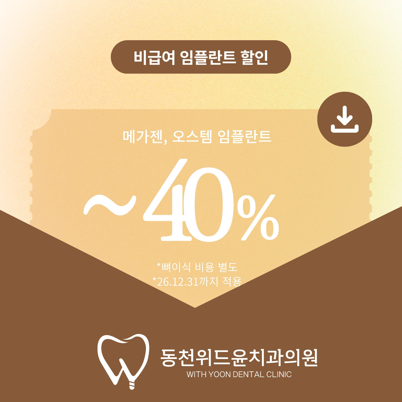 임플란트 이벤트